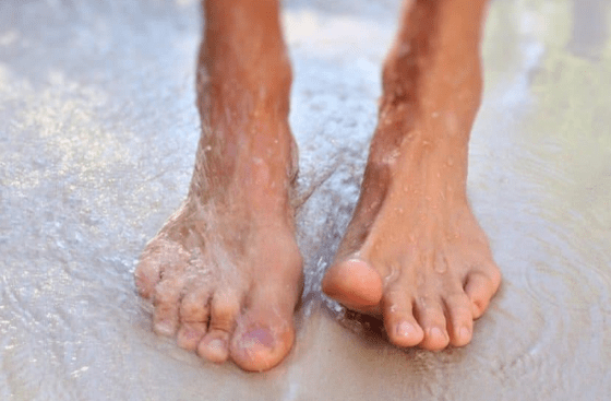 The reasons for the development of mycosis