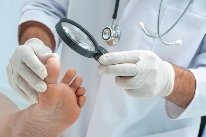 Before prescribing a treatment for toenail fungus, the doctor will conduct an examination